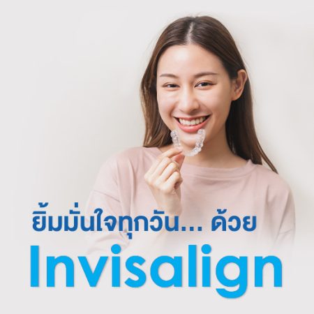 แพ็กเกจจัดฟันแบบใส (Invisalign)
