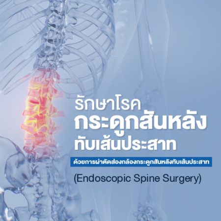 ผ่าตัดส่องกล้องโรคหมอนรองกระดูกสันหลังทับเส้นประสาท