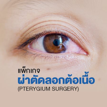 แพ็กเกจผ่าตัดลอกต้อเนื้อ (Pterygium Surgery)