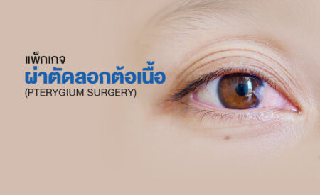 แพ็กเกจผ่าตัดลอกต้อเนื้อ (Pterygium Surgery)