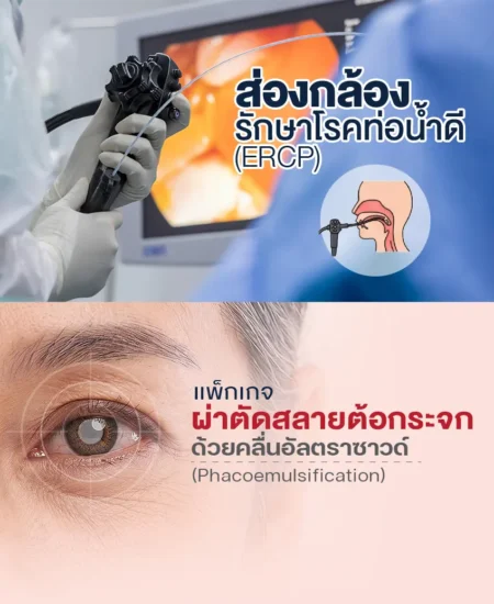 ผ่าตัดสลายต้อกระจก ด้วยคลื่นอัลตราซาวด์