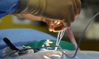 Trauma Surgery